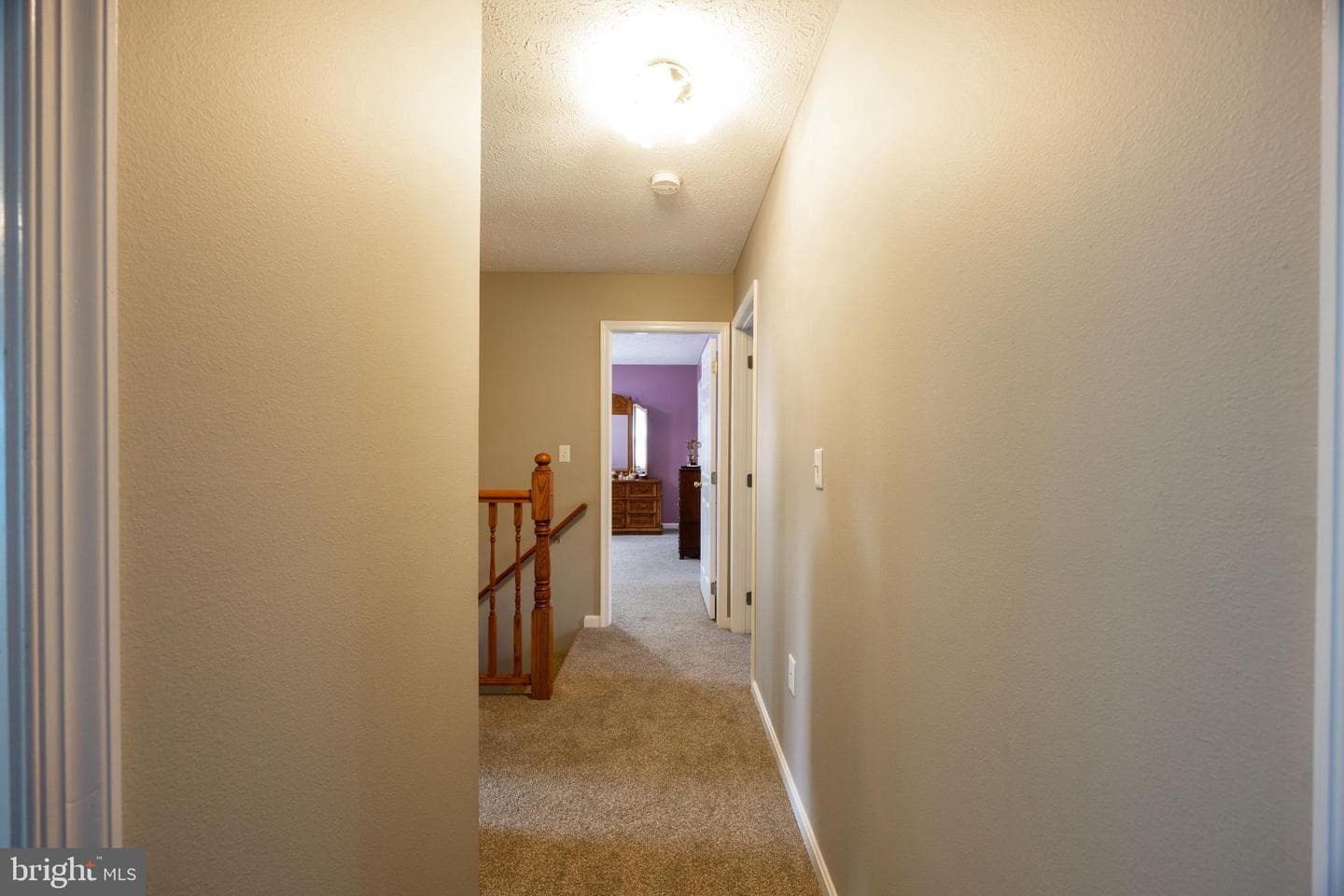 525 Appian Way photo 65